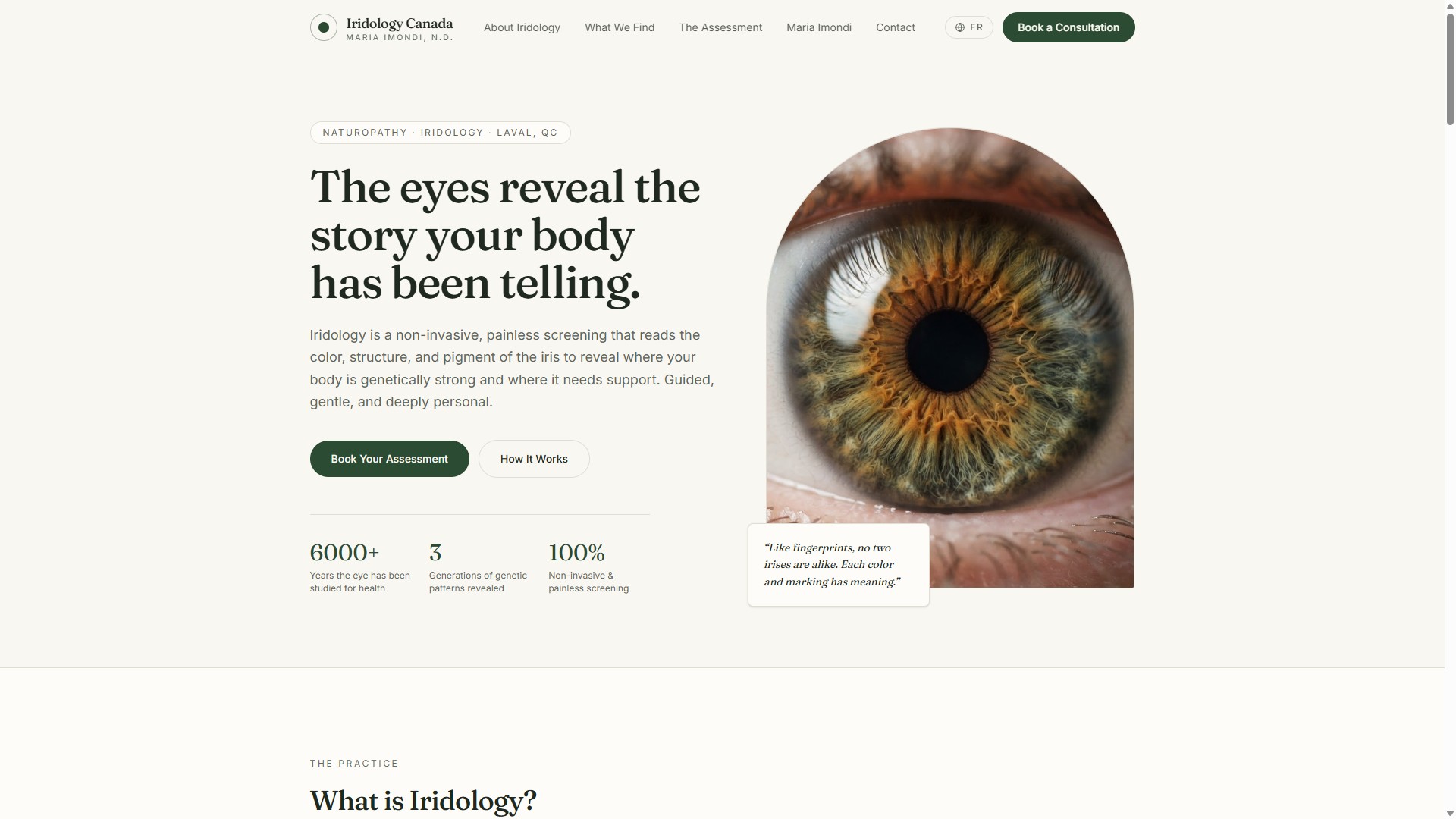 Iridology Canada - APRÈS